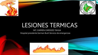 LESIONES TERMICAS
INT: CARMEN CARDOZO TAHUA
Hospital presidente German Bush Servicio de emergencias
 