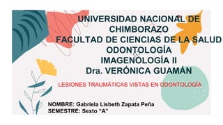 UNIVERSIDAD NACIONAL DE
CHIMBORAZO
FACULTAD DE CIENCIAS DE LA SALUD
ODONTOLOGÍA
IMAGENOLOGÍA II
Dra. VERÓNICA GUAMÁN
LESIONES TRAUMÁTICAS VISTAS EN ODONTOLOGÍA
NOMBRE: Gabriela Lisbeth Zapata Peña
SEMESTRE: Sexto “A”
 