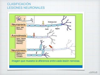 CLASIFICACIÓN
LESIONES NEURONALES
Dr. Vejarano A., Willy
Ortopedista y Traumatologo
 