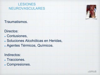 LESIONES
NEUROVASCULARES
Traumatismos.
Directos:
Contusiones,
Soluciones Alcohólicas en Heridas,
Agentes Térmicos, Químicos.
Indirectos:
Tracciones.
Compresiones.
Dr. Vejarano A., Willy
Ortopedista y Traumatologo
 