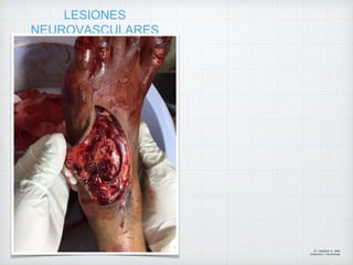 LESIONES
NEUROVASCULARES
Dr. Vejarano A., Willy
Ortopedista y Traumatologo
 