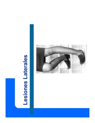 Lesiones
Laterales
 