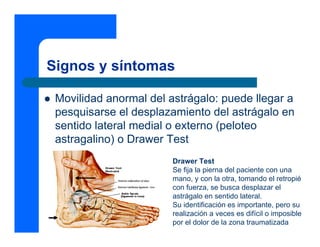 Signos y síntomas
z Movilidad anormal del astrágalo: puede llegar a
pesquisarse el desplazamiento del astrágalo en
sentido lateral medial o externo (peloteo
astragalino) o Drawer Test
Drawer Test
Se fija la pierna del paciente con una
mano, y con la otra, tomando el retropié
con fuerza, se busca desplazar el
astrágalo en sentido lateral.
Su identificación es importante, pero su
realización a veces es difícil o imposible
por el dolor de la zona traumatizada
 