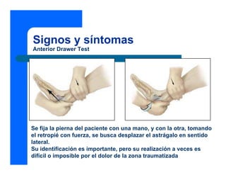 Signos y síntomas
Anterior Drawer Test
Se fija la pierna del paciente con una mano, y con la otra, tomando
el retropié con fuerza, se busca desplazar el astrágalo en sentido
lateral.
Su identificación es importante, pero su realización a veces es
difícil o imposible por el dolor de la zona traumatizada
 