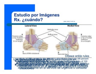 Estudio por Imágenes
Rx. ¿cuándo?
Una serie radiográfica de tobillo esta indicada en
pacientes con dolor en zona maleolar y en estas
situaciones
JAMA 1994;271:827-32.
z Sensibilidad ósea en A
z Sensibilidad ósea en B o inhabilidad en cargar peso
inmediatamente en el servicio de urgencia o consulta
Una serie radiográfica de tobillo esta indicada en
pacientes con dolor en zona media del pié y en estas
situaciones
z Sensibilidad ósea en C
z Sensibilidad ósea en D o inhabilidad en cargar peso
inmediatamente en el servicio de urgencia o consulta
Ottawa ankle rules
sensitivity of 100 percent for the detection of malleolar fractures (95 percent
confidence interval [CI]; range: 82 to 100 percent) and a sensitivity of 100
percent for the detection of midfoot fractures (95 percent CI; range: 95 to 100
percent)
 
