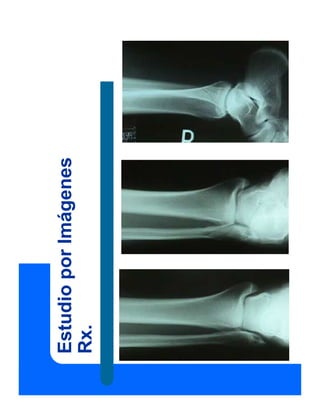 Estudio
por
Imágenes
Rx.
 