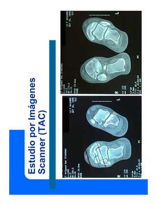 Estudio
por
Imágenes
Scanner
(TAC)
 