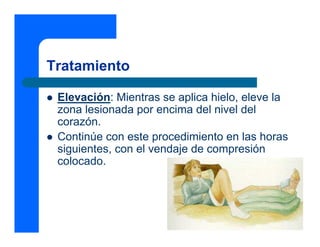 Tratamiento
z Elevación: Mientras se aplica hielo, eleve la
zona lesionada por encima del nivel del
corazón.
z Continúe con este procedimiento en las horas
siguientes, con el vendaje de compresión
colocado.
 