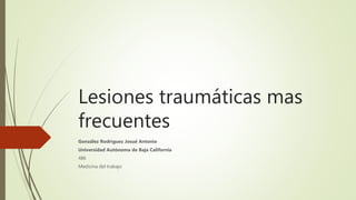 Lesiones traumáticas mas
frecuentes
González Rodríguez Josué Antonio
Universidad Autónoma de Baja California
486
Medicina del trabajo
 