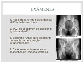 • 1. Radiografía AP de pelvis: detecta
el 80% de las fracturas.
• 2. TAC: es el examen de elección o
“gold standard”
• 3. Ecografía FAST: para detectar la
presencia de hemorragias
intraperitoneales.
• 4. Cistouretrografía retrógrada:
sospechas de lesiones uretrales.
EXÁMENES
 