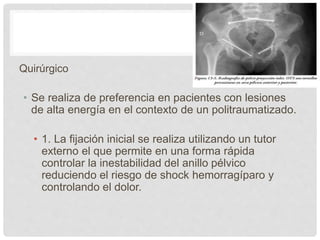 Quirúrgico
• Se realiza de preferencia en pacientes con lesiones
de alta energía en el contexto de un politraumatizado.
• 1. La fijación inicial se realiza utilizando un tutor
externo el que permite en una forma rápida
controlar la inestabilidad del anillo pélvico
reduciendo el riesgo de shock hemorragíparo y
controlando el dolor.
 