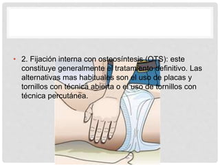 • 2. Fijación interna con osteosíntesis (OTS): este
constituye generalmente el tratamiento definitivo. Las
alternativas mas habituales son el uso de placas y
tornillos con técnica abierta o el uso de tornillos con
técnica percutánea.
 