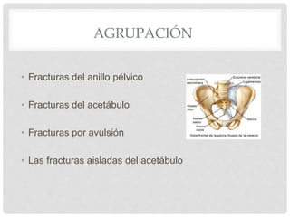 AGRUPACIÓN
• Fracturas del anillo pélvico
• Fracturas del acetábulo
• Fracturas por avulsión
• Las fracturas aisladas del acetábulo
 