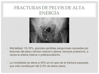 FRACTURAS DE PELVIS DE ALTA
ENERGÍA
• Mortalidad: 10-16%, grandes perdidas sanguíneas causadas por
lesiones del plexo venoso vesical o plexos venosos presacros, a
veces la arteria interna o politraumatismo.
• La mortalidad se eleva a 45% en el caso de la fractura expuesta,
que solo constituyen del 2-4% de estos casos.
 