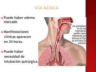  Puedehaber edema
 marcado

 Manifestaciones
 clínicas aparecen
 en 24 horas.

 Puedehaber
 necesidad de
 intubación quirúrgica.
 