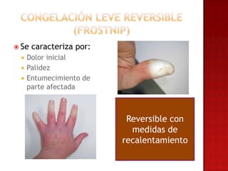  Se   caracteriza por:
    Dolor inicial
    Palidez
    Entumecimiento de
     parte afectada



                           Reversible con
                            medidas de
                          recalentamiento
 
