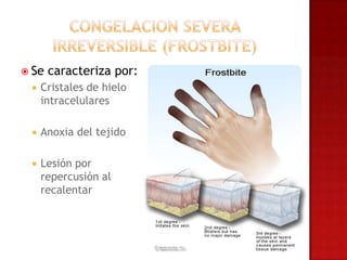  Se   caracteriza por:
    Cristales de hielo
     intracelulares

    Anoxia del tejido

    Lesión por
     repercusión al
     recalentar
 