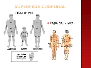  Regla   del Nueve
 