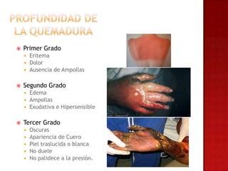    Primer Grado
     Eritema
     Dolor
     Ausencia de Ampollas


   Segundo Grado
     Edema
     Ampollas
     Exudativa e Hipersensible


   Tercer Grado
       Oscuras
       Apariencia de Cuero
       Piel traslucida o blanca
       No duele
       No palidece a la presión.
 