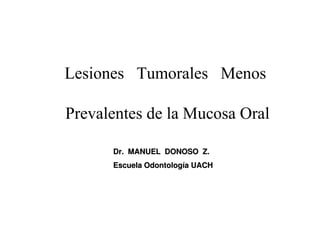 Lesiones Tumorales Menos

Prevalentes de la Mucosa Oral

      Dr. MANUEL DONOSO Z.
      Escuela Odontología UACH
 