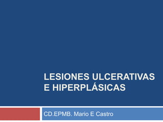 LESIONES ULCERATIVAS
E HIPERPLÁSICAS
CD.EPMB. Mario E Castro
 
