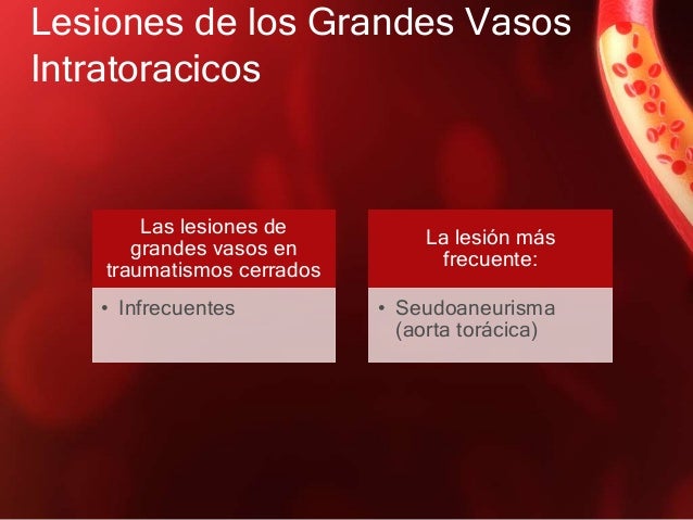 El crujido en los cuellos y el dolor en