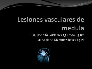 Lesiones vasculares de medula Dr. Rodolfo Gutierrez Quiroga R3 Rx Dr. Adriano Martínez Reyes R5 N 