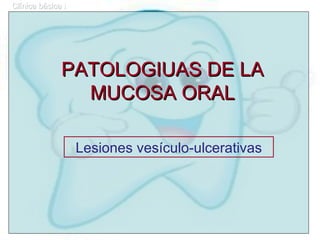 PATOLOGIUAS DE LA MUCOSA ORAL Lesiones vesículo-ulcerativas Clínica básica I 