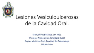 Lesiones Vesiculoulcerosas
de la Cavidad Oral.
Manuel Paz Betanco. CD. MSc.
Profesor Asistente de Patología Bucal
Depto. Medicina Oral, Facultad de Odontología
UNAN-León
 