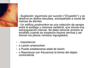 Lesiones Y Contusiones