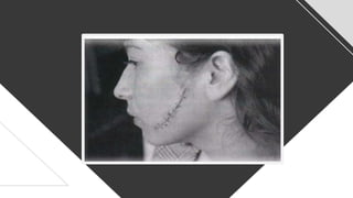 whoa!
This can be the part of the presentation where you
introduce yourself, write your email...
 