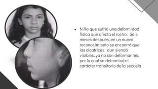 ● Niña que sufrió una deformidad
física que afecta el rostro. Seis
meses después, en un nuevo
reconocimiento se encontró que
las cicatrices. aun siendo
visibles, ya no son deformantes,
por lo cual se determinó el
carácter transitorio de la secuela
 