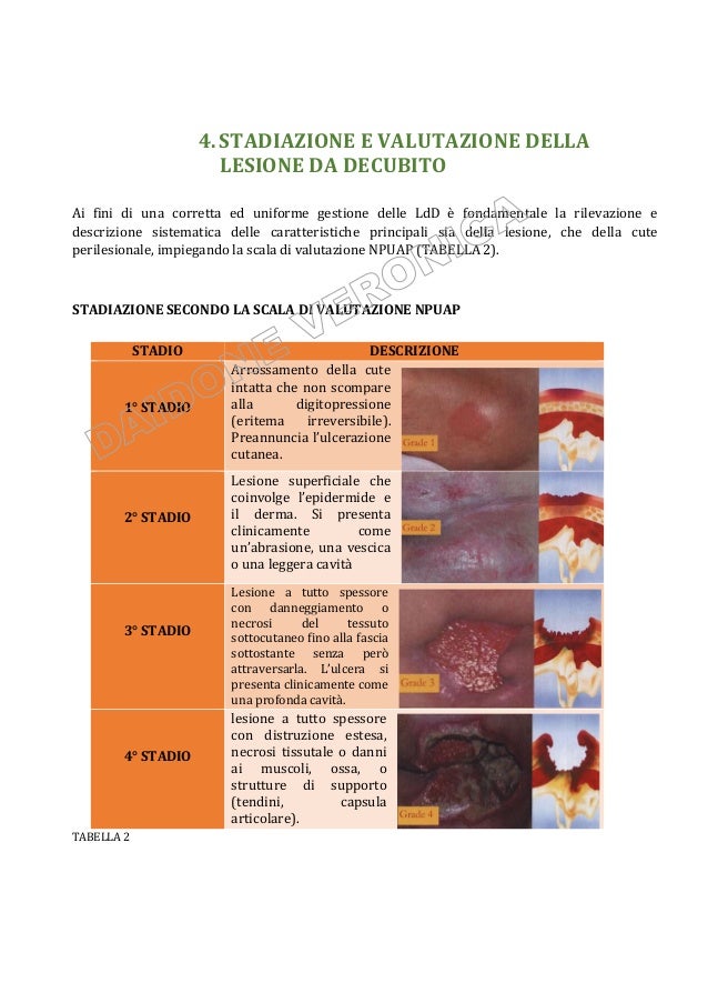 Lesioni da decubito Lesioni da decubito