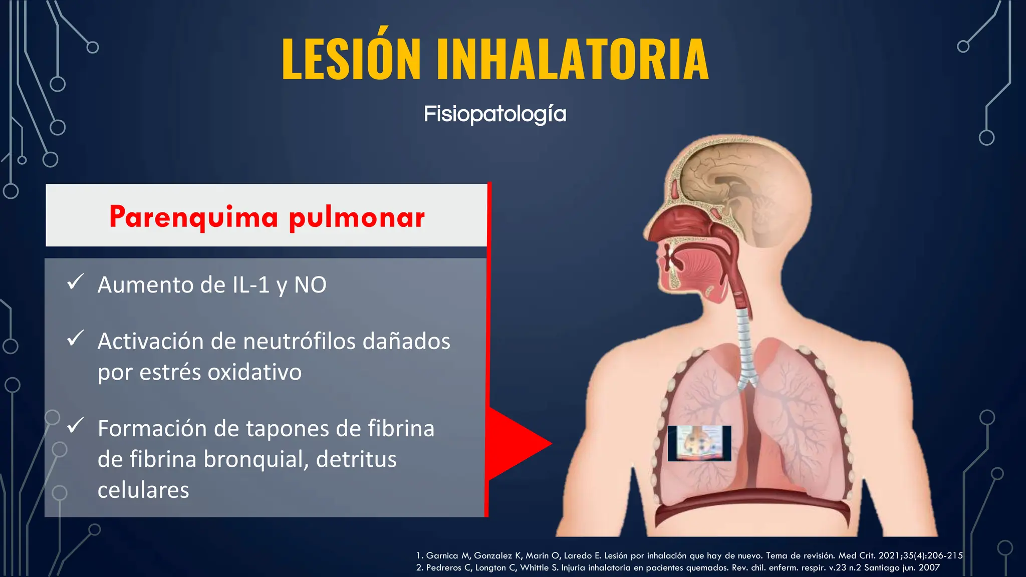 lesion inhalatoria en quemaduras fisiopatología y manejo | PPTX