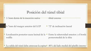 Tibia Salida Lesion ligamentos cruzados.pptx