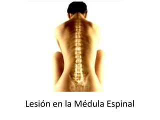 Lesión en la Médula Espinal
 