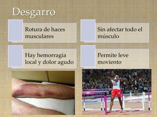 Desgarro
  Rotura de haces       Sin afectar todo el
  musculares            músculo


  Hay hemorragia        Permite leve
  local y dolor agudo   moviento
 