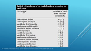Ian Wooda et all Non-carious cervical tooth surface loss: A literature review journal of dentistry 36 (2008) 759–766
 