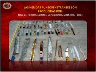 LAS HERIDAS PUNZOPENETRANTES SON
PRODUCIDAS POR:
Navajas, Puñales, Estiletes, Corta plumas, Machetes, Tijeras
 