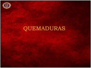 QUEMADURAS
 