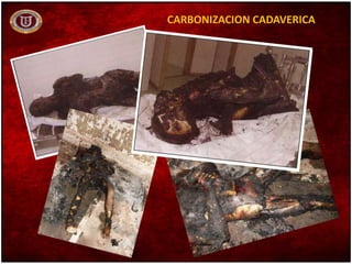 CARBONIZACION CADAVERICA
 