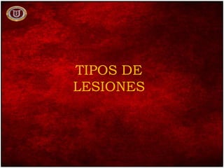 TIPOS DE
LESIONES
 
