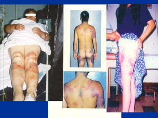 Dr. Carlos Moreno Sánchez 18
 