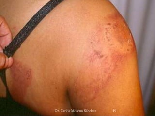 Dr. Carlos Moreno Sánchez 19
 