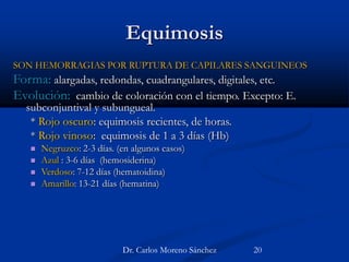 Equimosis
SON HEMORRAGIAS POR RUPTURA DE CAPILARES SANGUINEOS
Forma: alargadas, redondas, cuadrangulares, digitales, etc.
Evolución: cambio de coloración con el tiempo. Excepto: E.
subconjuntival y subungueal.
* Rojo oscuro: equimosis recientes, de horas.
* Rojo vinoso: equimosis de 1 a 3 días (Hb)
 Negruzco: 2-3 días. (en algunos casos)
 Azul : 3-6 días (hemosiderina)
 Verdoso: 7-12 días (hematoidina)
 Amarillo: 13-21 días (hematina)
Dr. Carlos Moreno Sánchez 20
 
