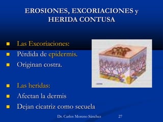 EROSIONES, EXCORIACIONES y
HERIDA CONTUSA
 Las Excoriaciones:
 Pérdida de epidermis.
 Originan costra.
 Las heridas:
 Afectan la dermis
 Dejan cicatriz como secuela
Dr. Carlos Moreno Sánchez 27
 