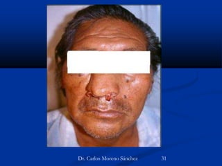 Dr. Carlos Moreno Sánchez 31
 