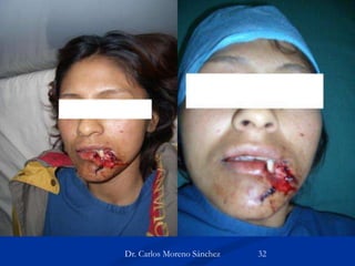 Dr. Carlos Moreno Sánchez 32
 