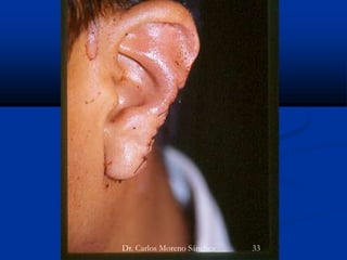 Dr. Carlos Moreno Sánchez 33
 