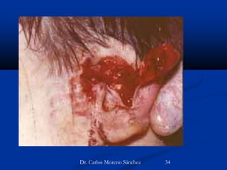 Dr. Carlos Moreno Sánchez 34
 